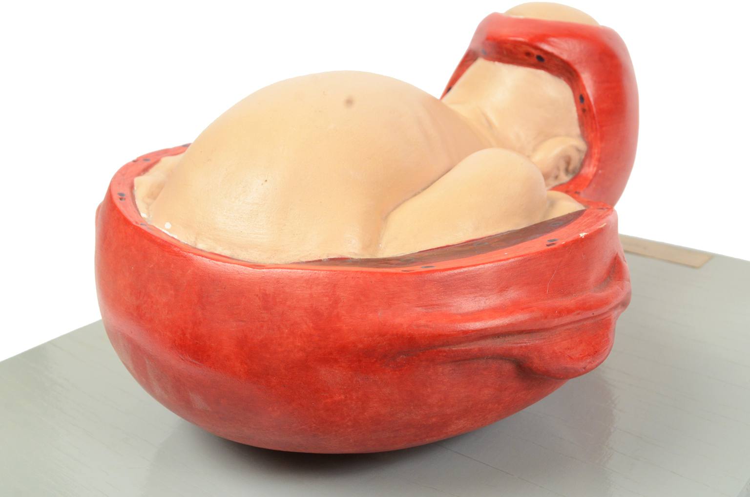 Old medical instruments/4075-Borning baby