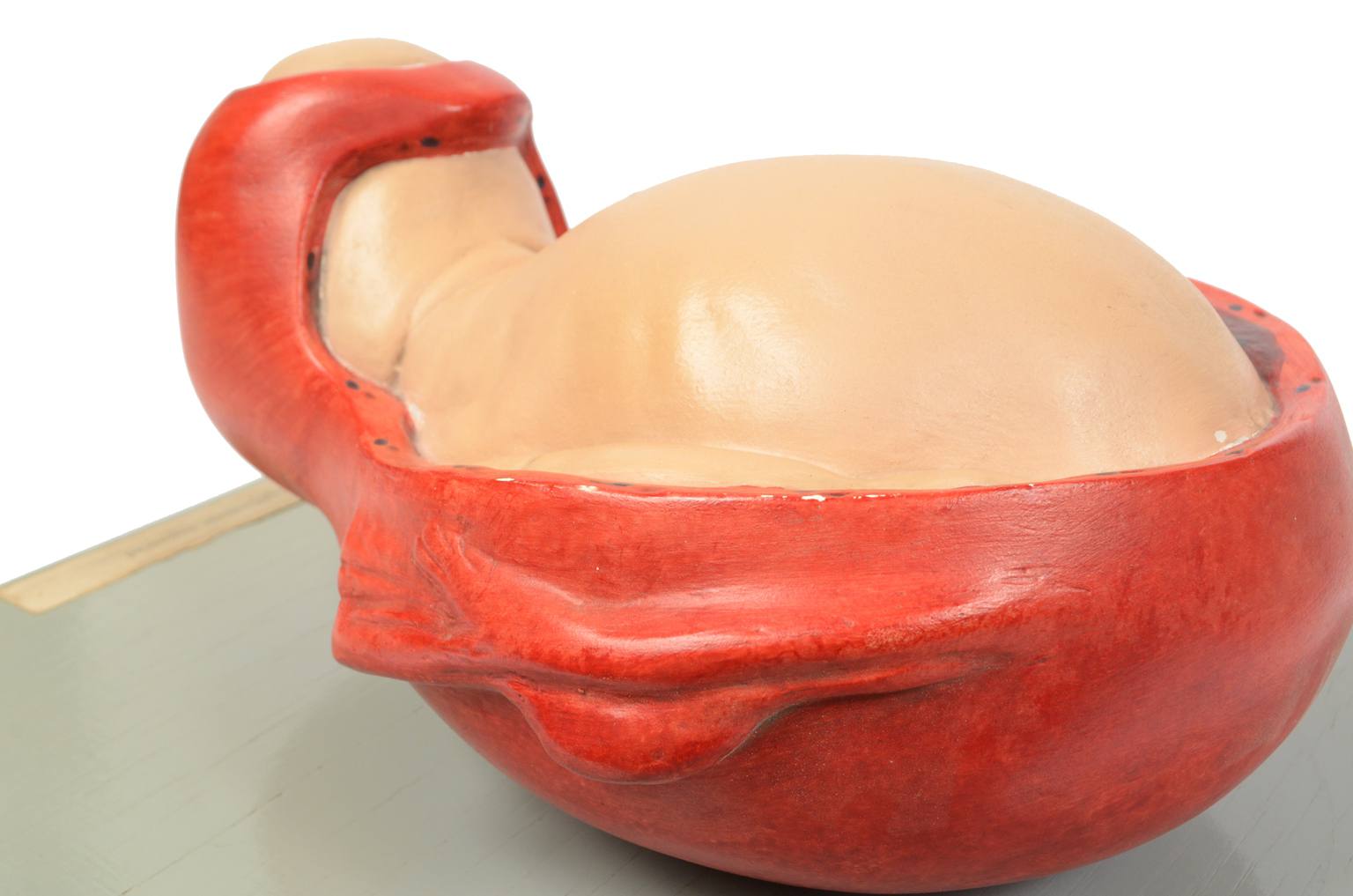 Old medical instruments/4075-Borning baby