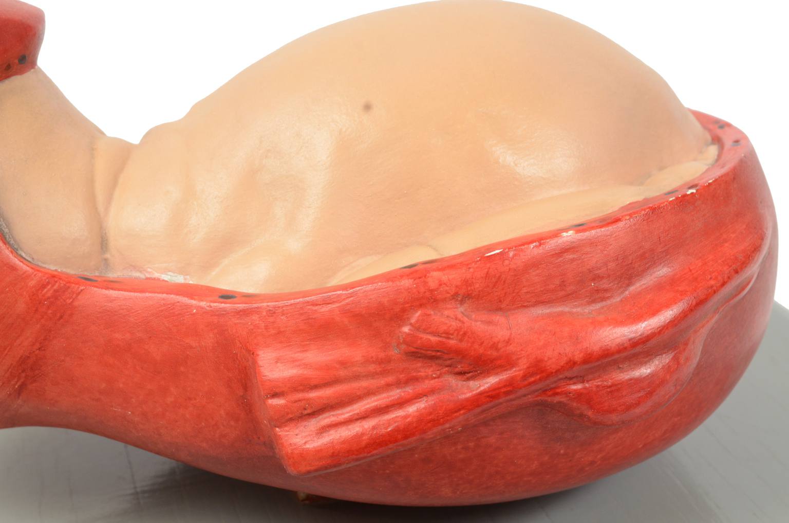 Old medical instruments/4075-Borning baby