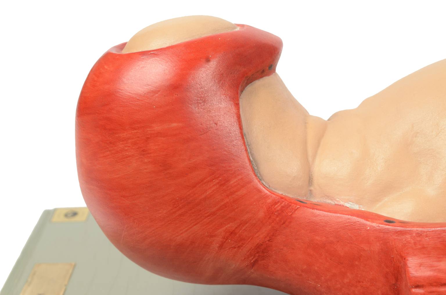 Old medical instruments/4075-Borning baby