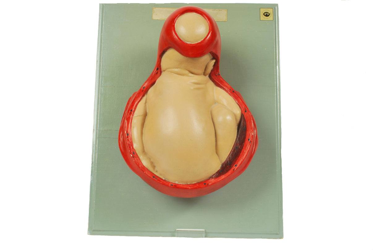Strumenti medici d'epoca/4075-Bambino che nasce