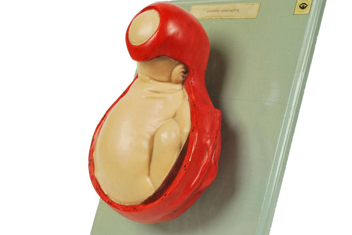 Strumenti medici d'epoca/4075-Bambino che nasce