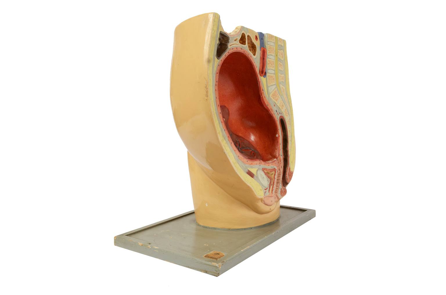 Strumenti medici d'epoca/4076-Ventre di donna