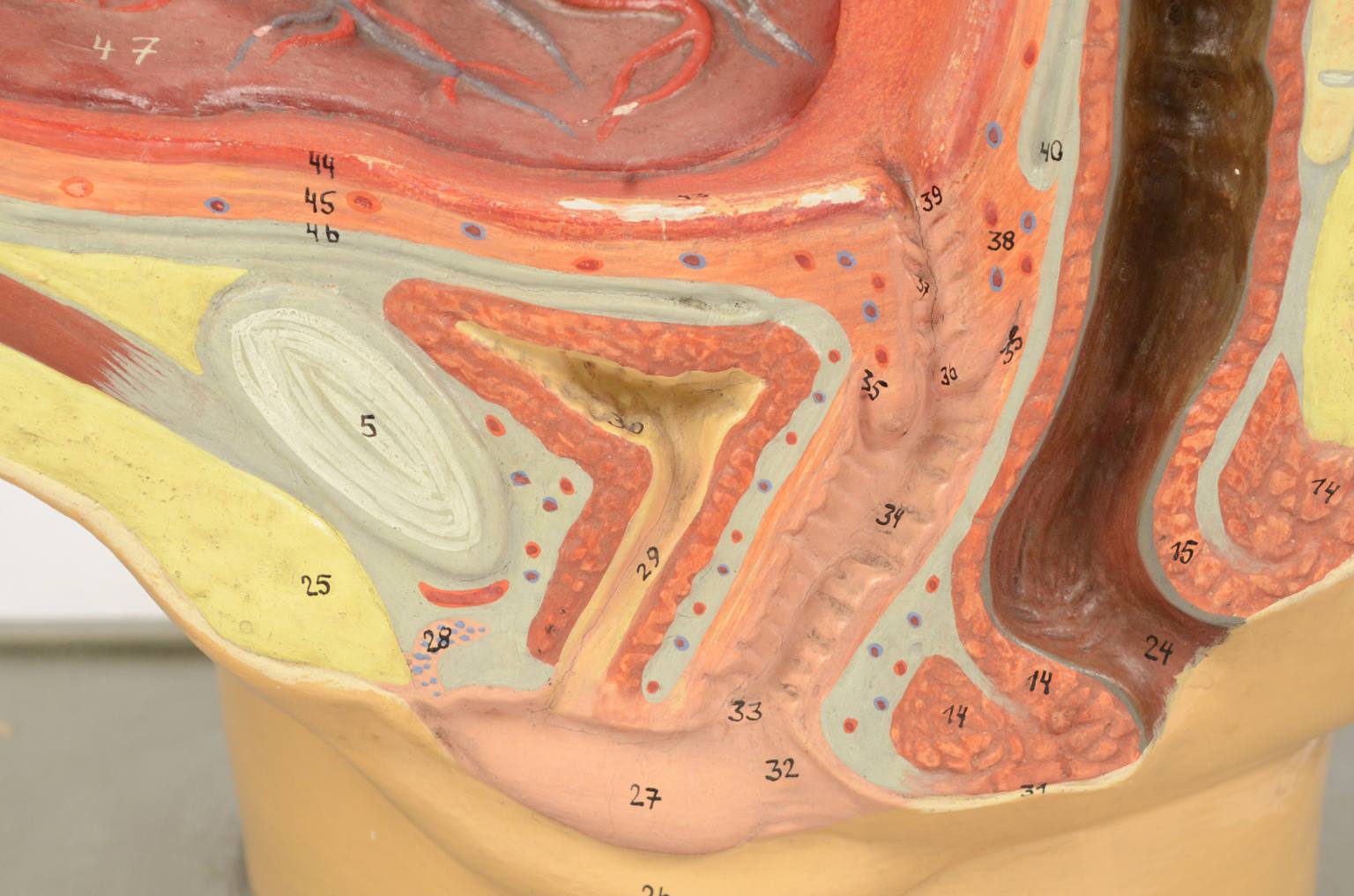 Old medical instruments/4076-Woman womb