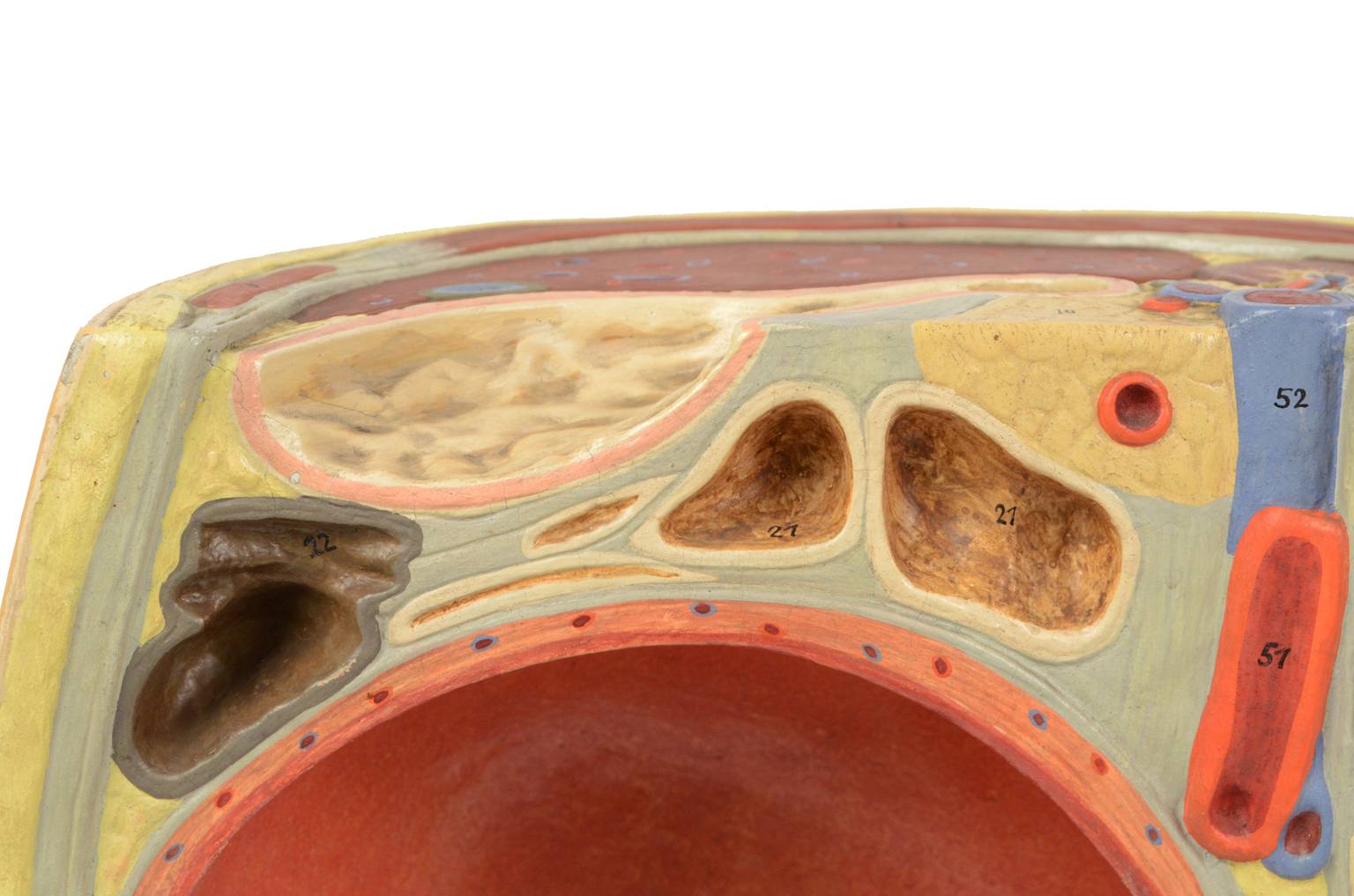 Old medical instruments/4076-Woman womb