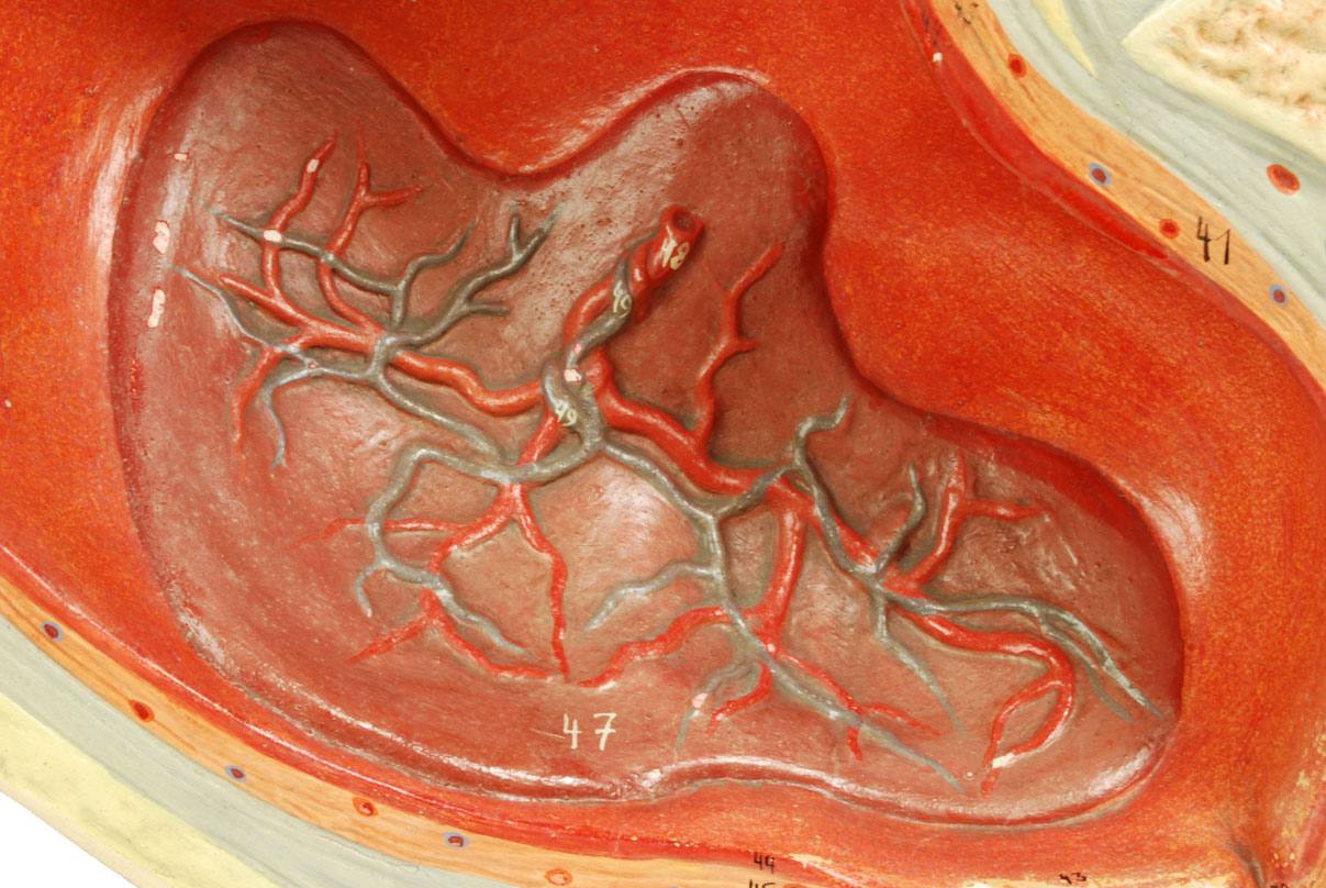 Strumenti medici d'epoca/4076-Ventre di donna