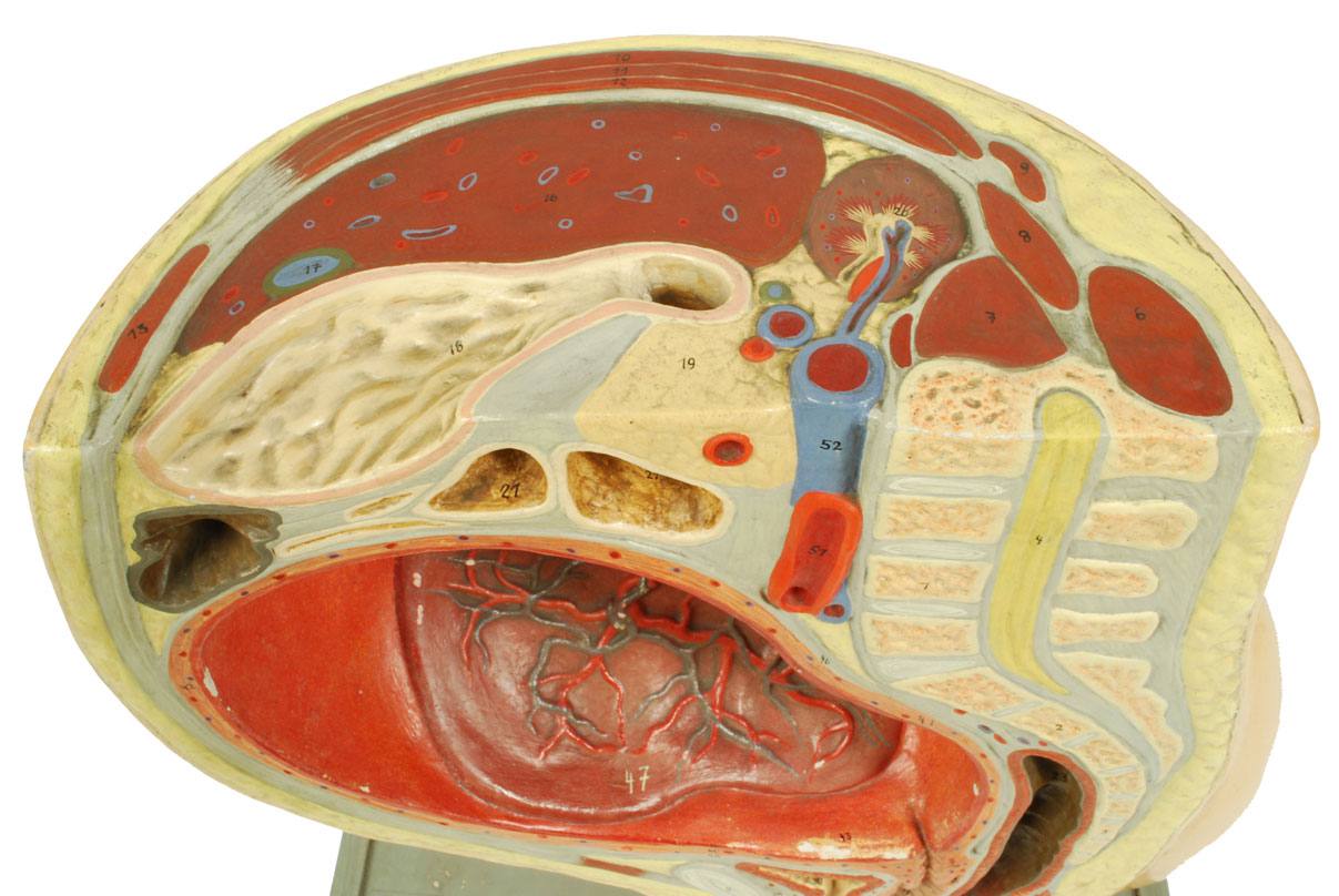 Old medical instruments/4076-Woman womb