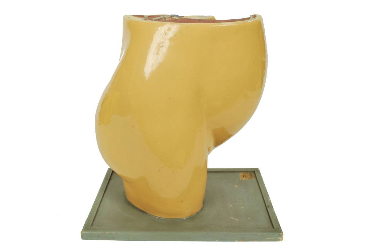 Strumenti medici d'epoca/4076-Ventre di donna