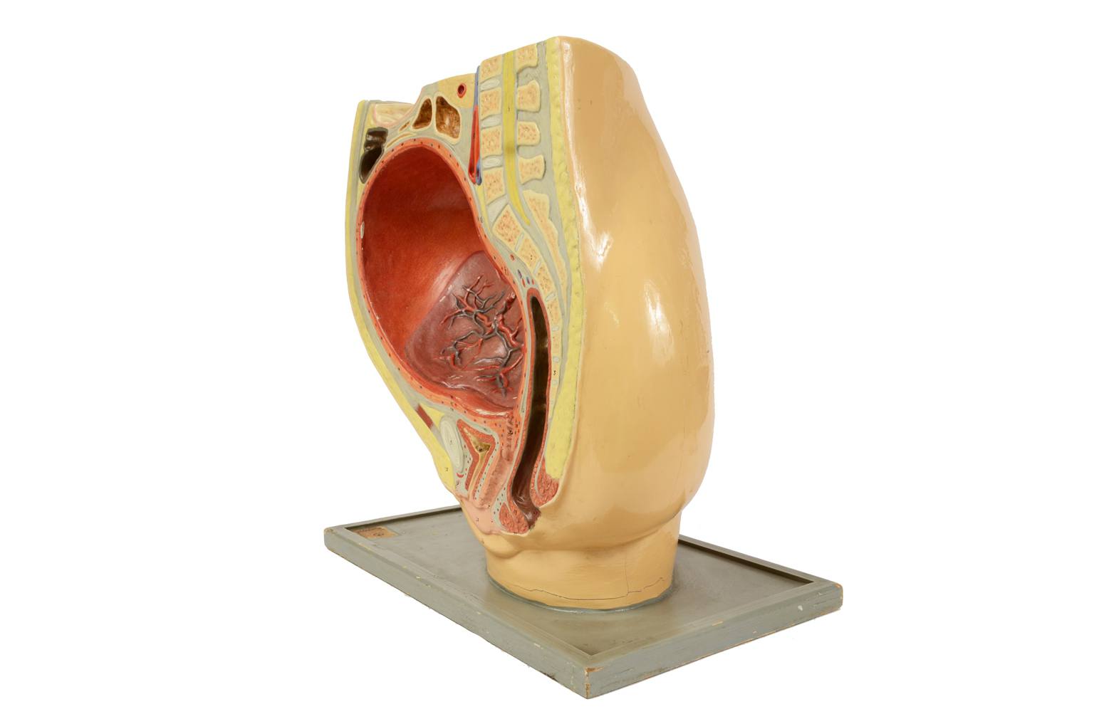 Old medical instruments/4076-Woman womb