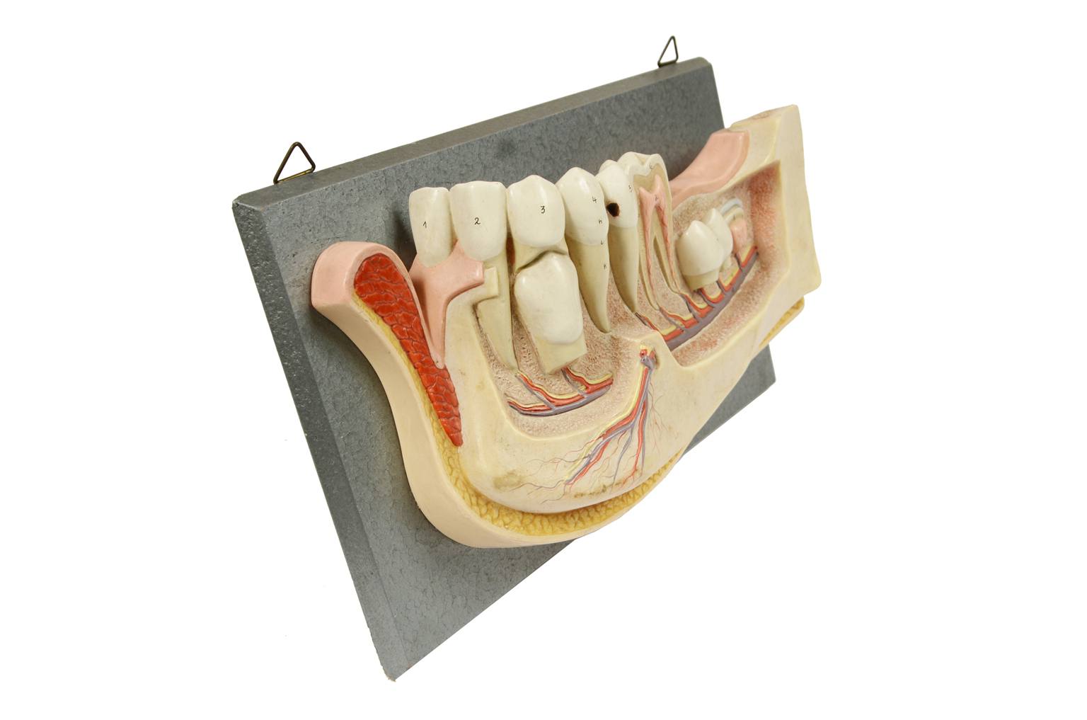 Old medical instruments/541A-Jaw model