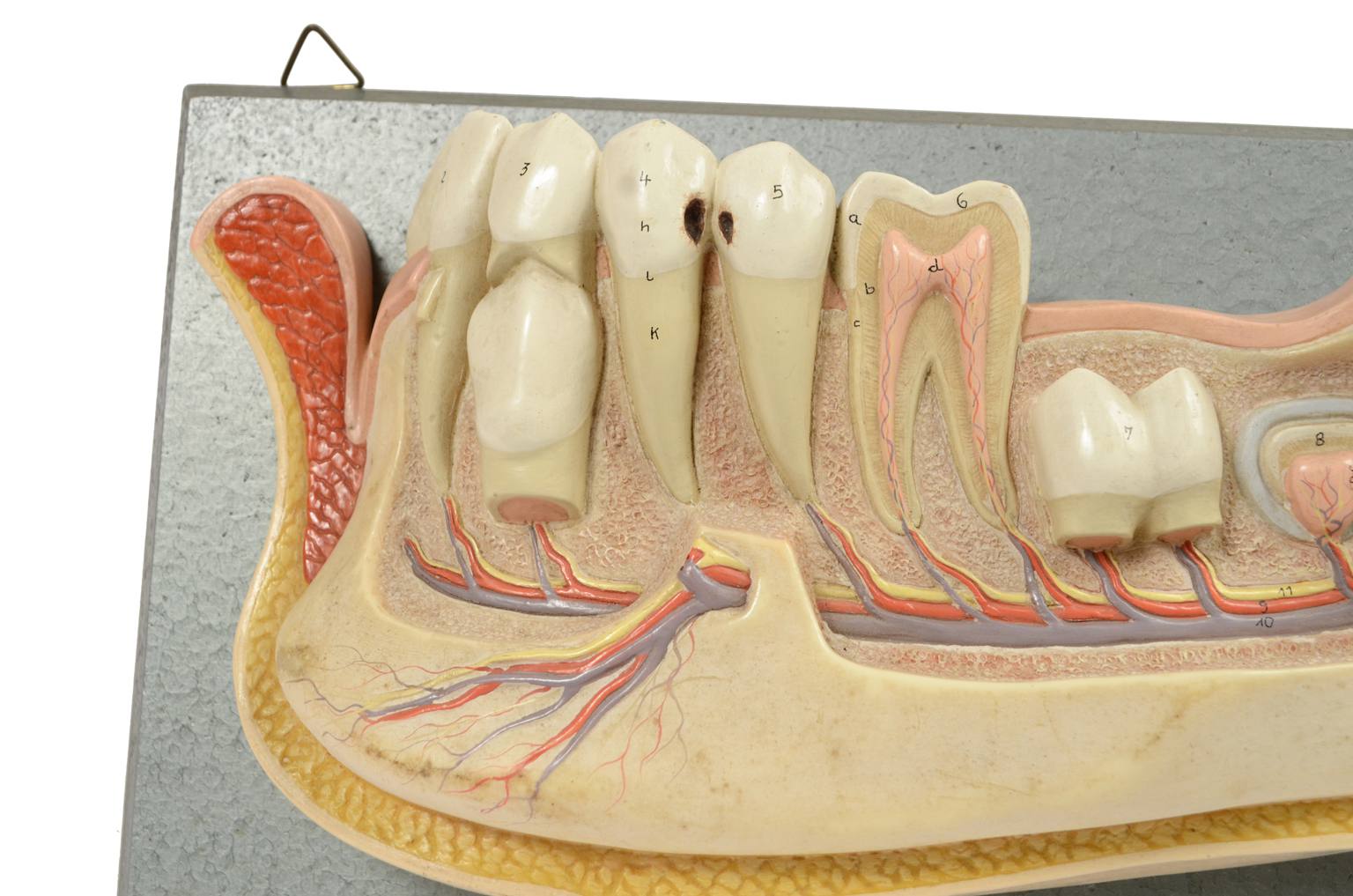 Old medical instruments/541A-Jaw model