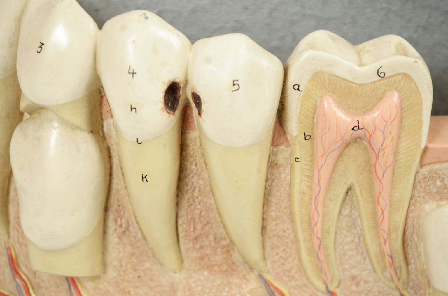 Old medical instruments/541A-Jaw model
