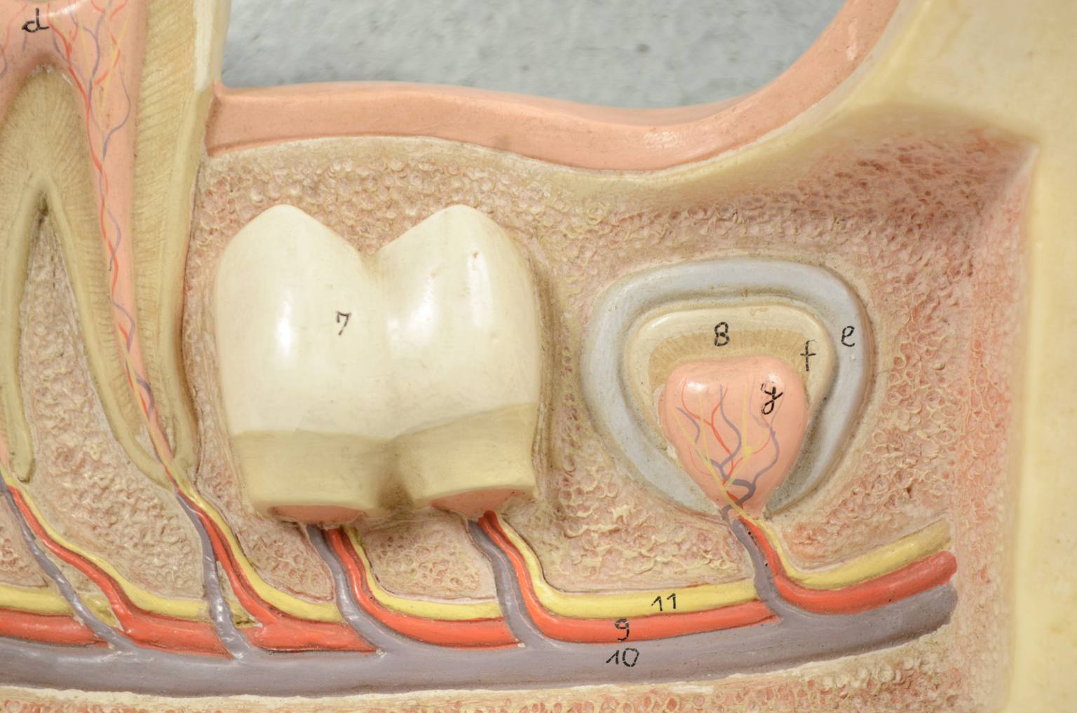 Old medical instruments/541A-Jaw model