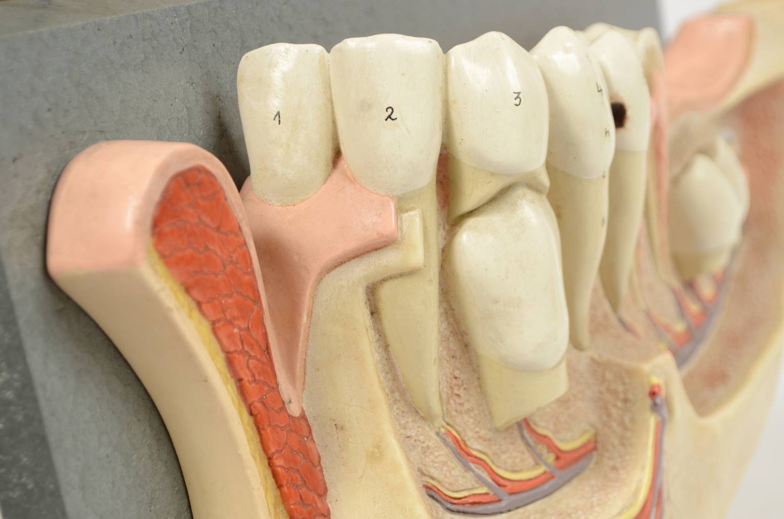 Old medical instruments/541A-Jaw model