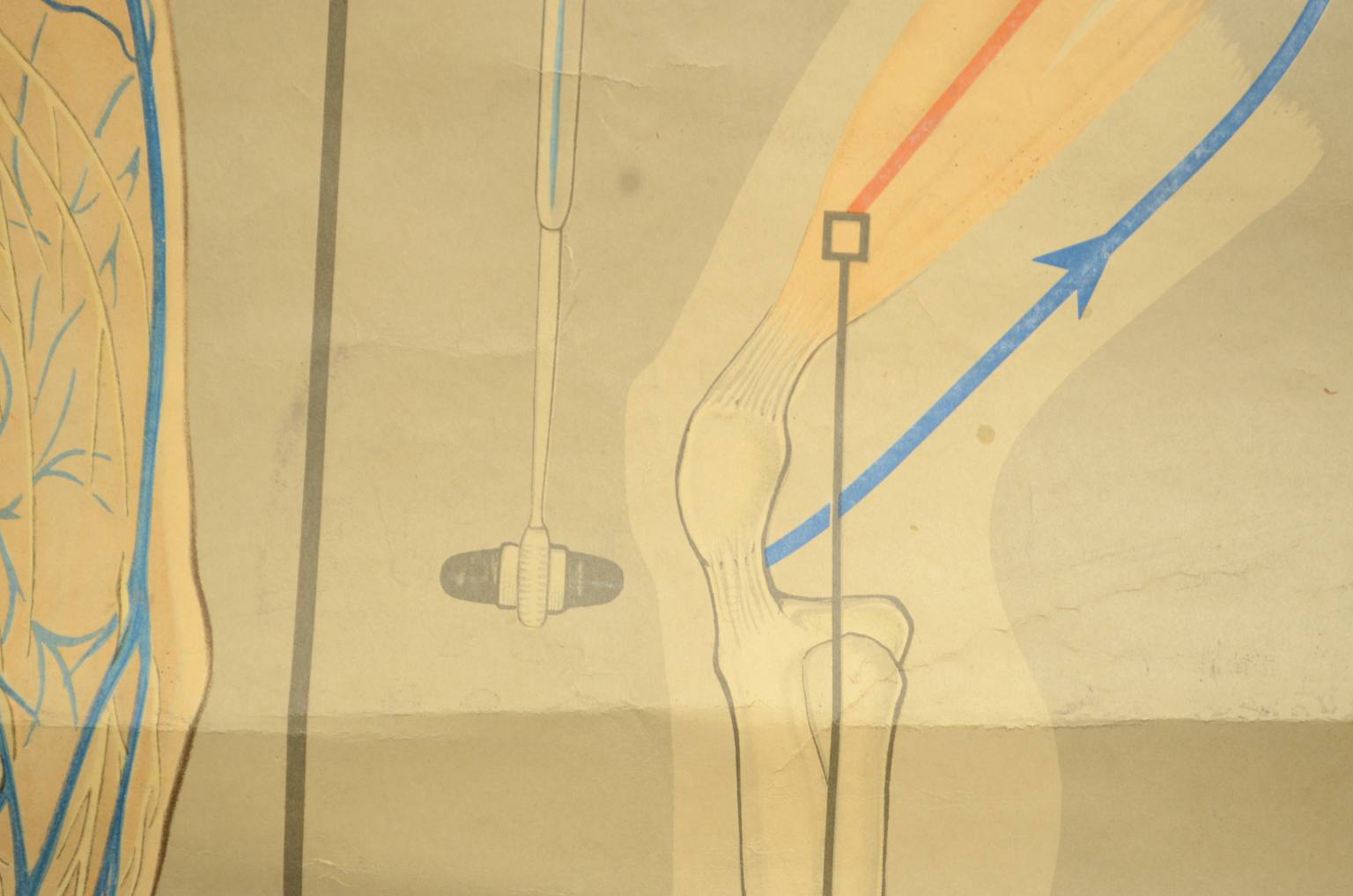 Old medical instruments/544A-Anatomical plate