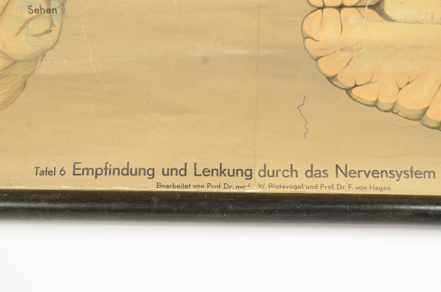 Old medical instruments/544A-Anatomical plate