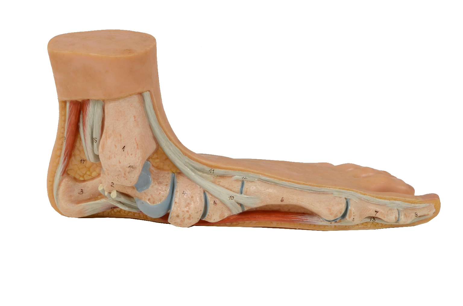 Old medical instruments/7306-Flat Foot Model