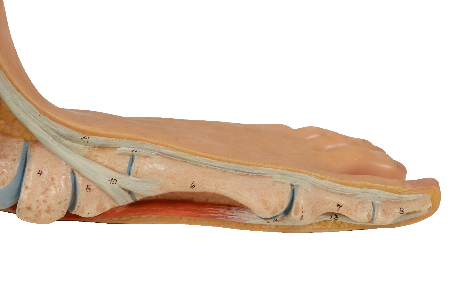 Strumenti medici d'epoca/7306-Piede Piatto Modello